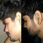 gemini-2.5-flash-image-preview (nano-banana)_ده_زيت_نمو_اللحيه_اص